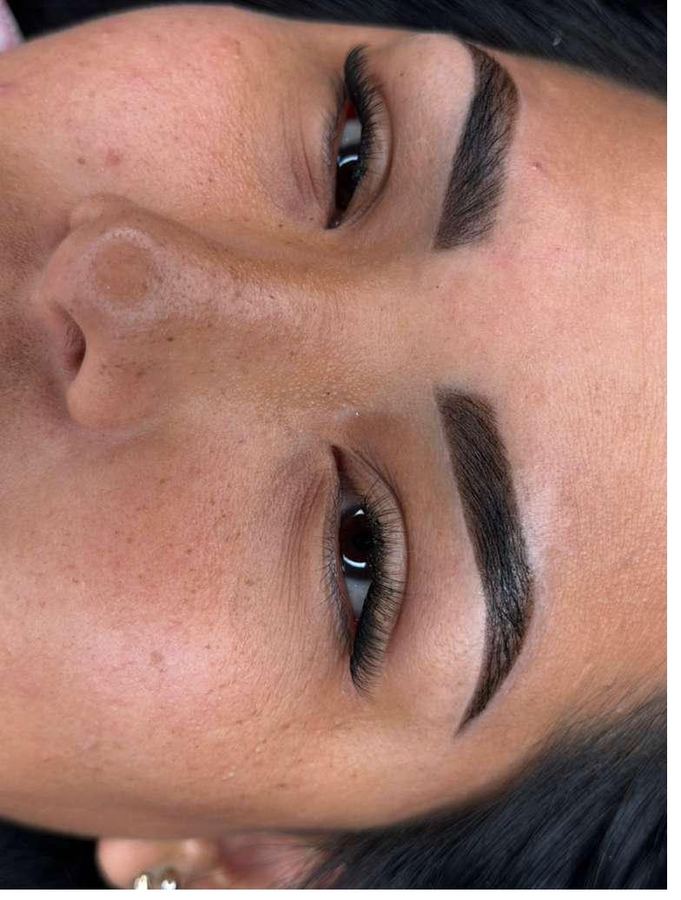 Finished brow seen from the side